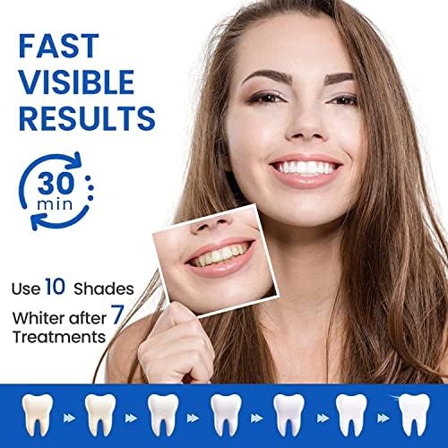 Избелващи Ленти за зъби, 28 бр Избелващи Ленти за Чувствителни зъби, Ефективно и Безопасно Избелващи Ленти За зъби с намалена чувствителност