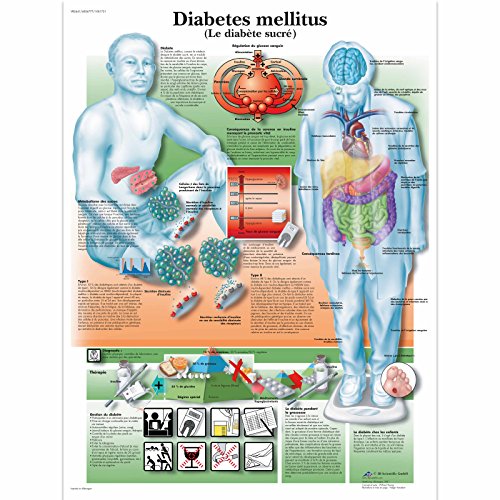 3Б Scientific VR2441L Лъскав, Устойчив на UV Ламинирана хартия Le Diabete Anatomical (Анатомическая карта на захарен диабет, на френски